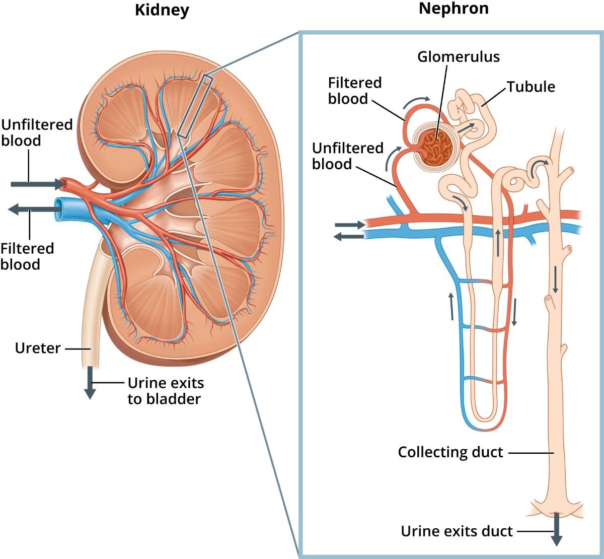 سندرم نفروتیک (Nephrotic syndrome)